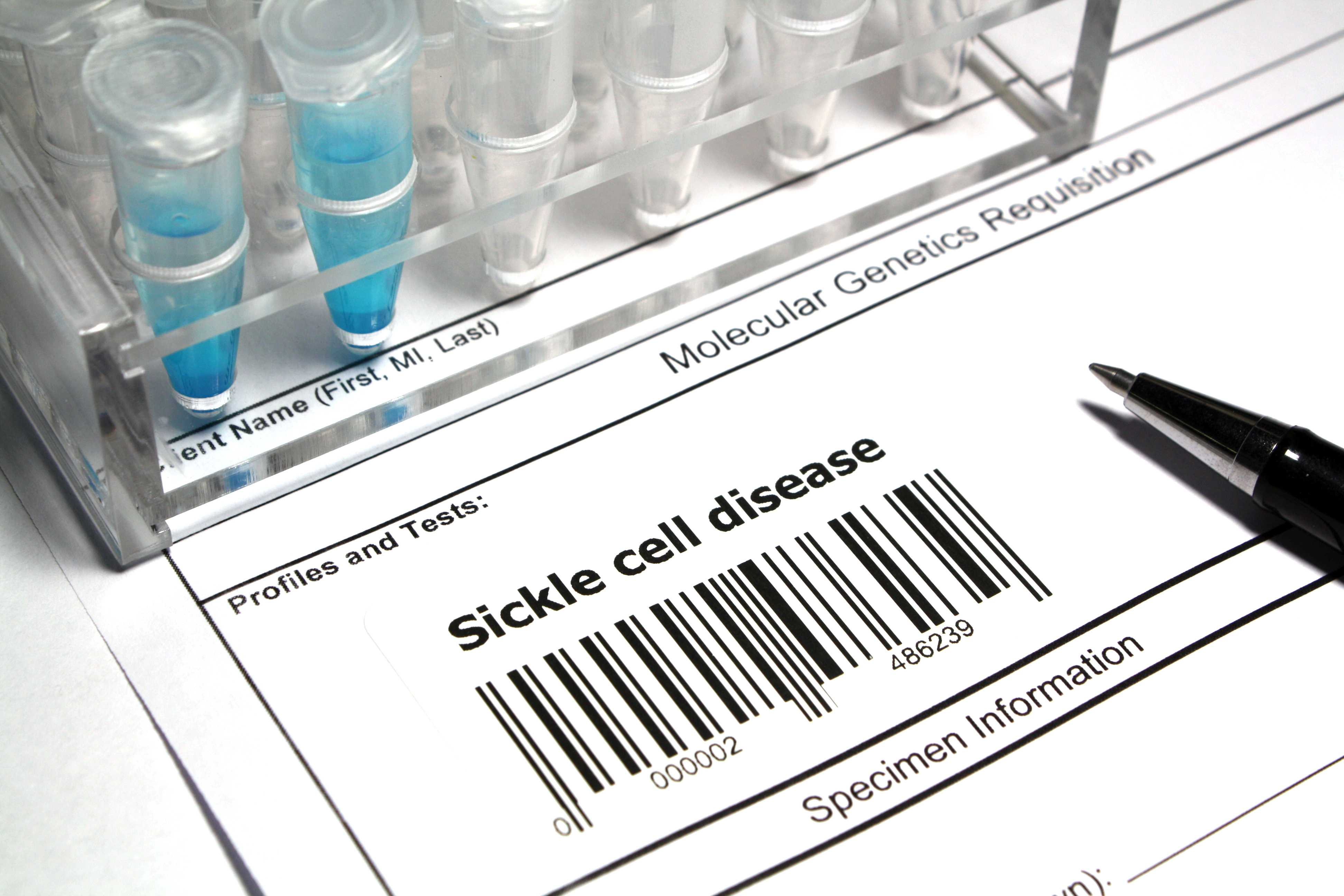barcode on lab sample that shows sickle cell disease